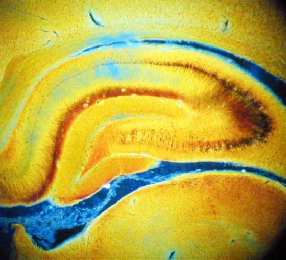 Brainstorms. Художник в контексте нейронаук – афиша